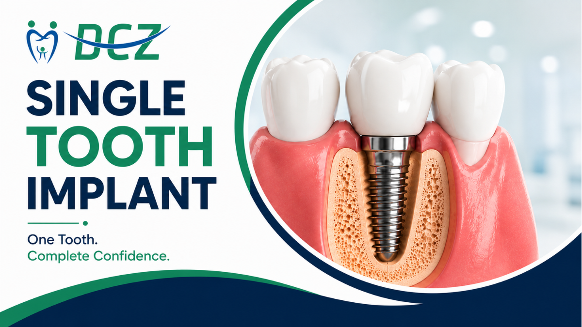 A Single Tooth Implant offers a permanent, natural-looking replacement for a missing tooth, helping you smile, speak, and eat with confidence.